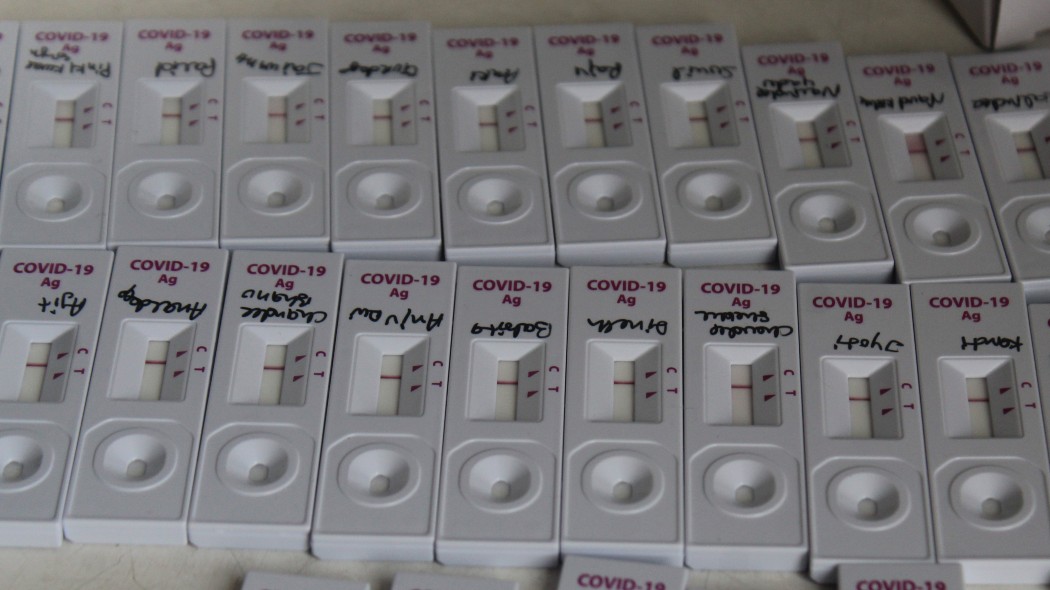 Test rapidi per il coronavirus, cosa sono e come funzionano