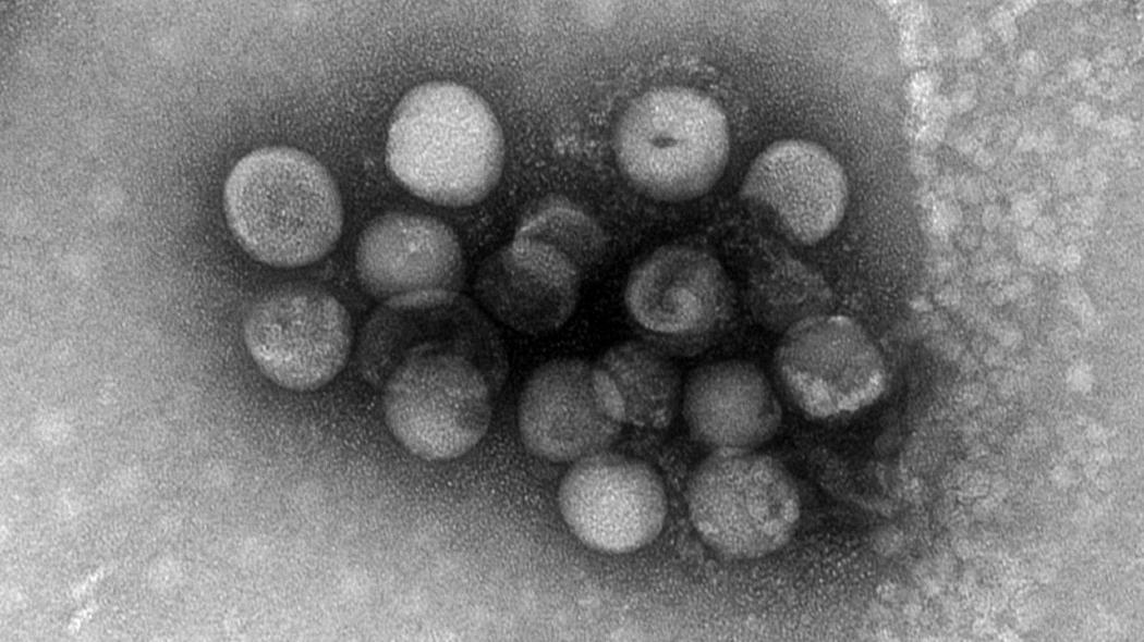Altri due nuovi coronavirus potrebbero infettare le persone