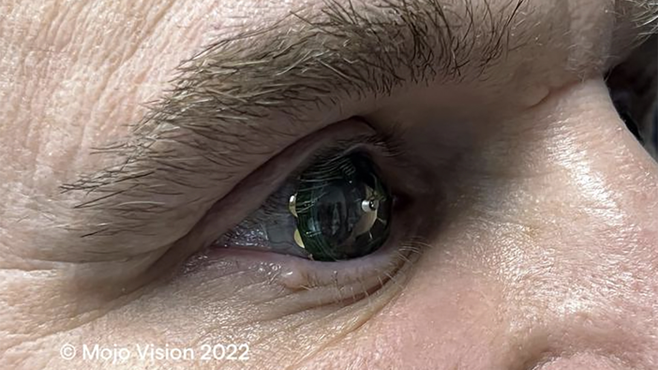 La lista della spesa sugli occhi con le lenti a contatto smart di Mojo Vision