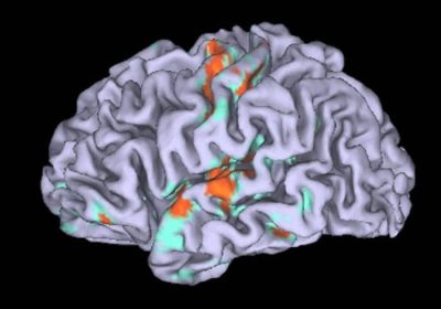 Differenze cerebrali tra uomini e donne: l’IA rivela nuove scoperte – Software e App