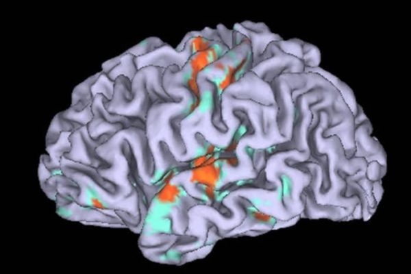 Differenze cerebrali tra uomini e donne: l’IA rivela nuove scoperte – Software e App