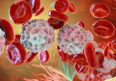 Leucemia, testata una nuova tecnica per sostituire gradualmente il sangue malato con quello sano