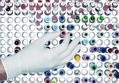 Hiv, la nuova grande speranza per un vaccino