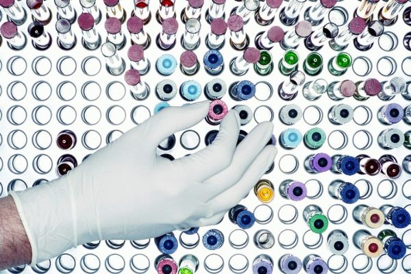 Hiv, la nuova grande speranza per un vaccino