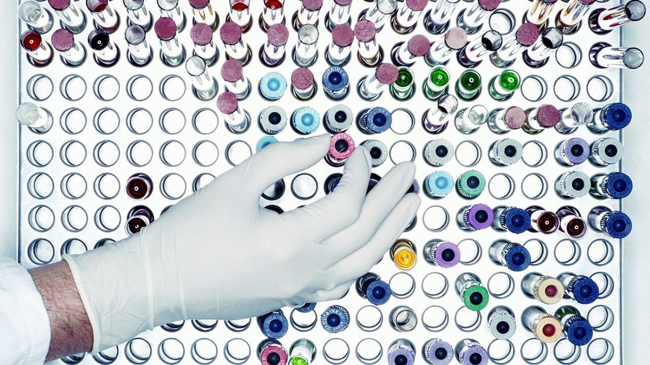 Hiv, la nuova grande speranza per un vaccino