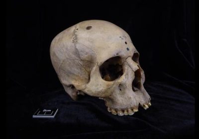 Antico Egitto, scoperto un cranio con segni di interventi chirurgici per un tumore al cervello