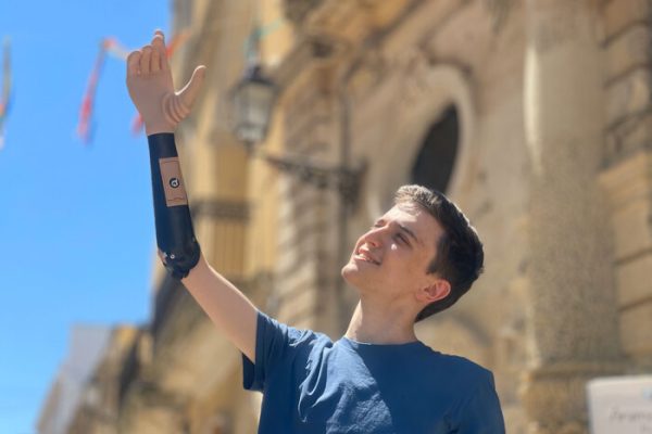 La startup Future Tech raccoglie 5,5 milioni di euro per la sua prima mano bionica su misura