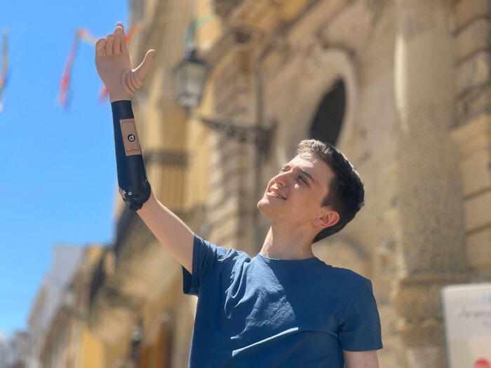 La startup Future Tech raccoglie 5,5 milioni di euro per la sua prima mano bionica su misura