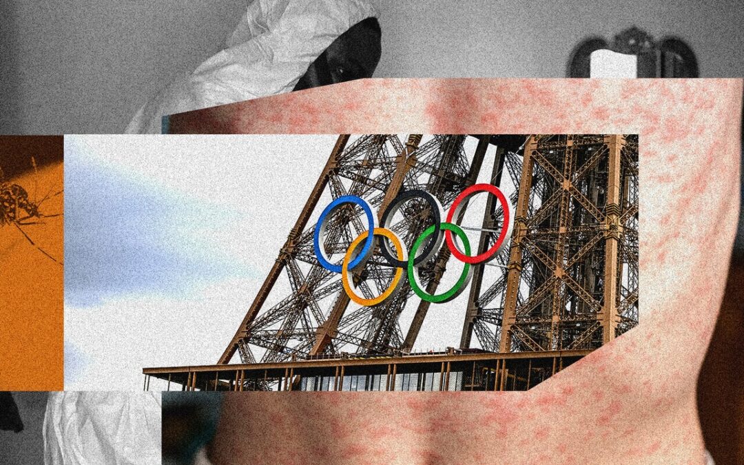 Olimpiadi 2024, i Giochi di Parigi rischiano un’epidemia di dengue e morbillo?