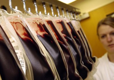 Trasfusione di sangue sbagliata, cosa succede e come si interviene