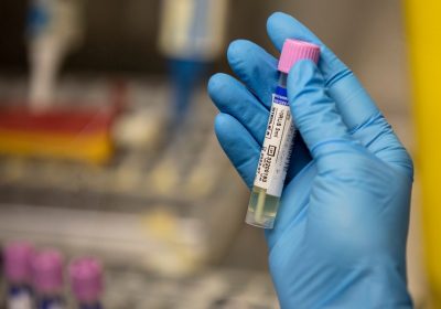 Il vaiolo delle scimmie è diventato un’emergenza sanitaria in Africa