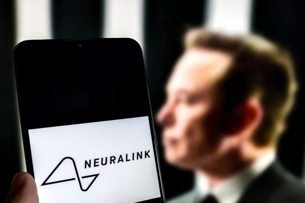 Cosa sappiamo del secondo chip Neuralink impiantato nel cervello di un essere umano