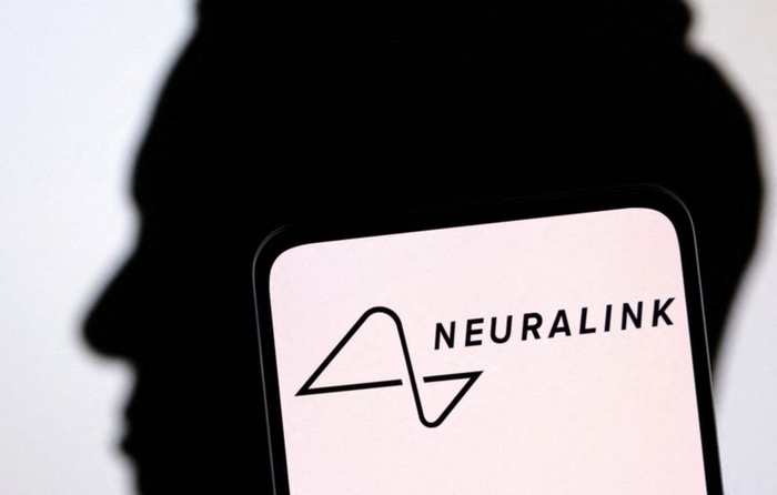 Neuralink supera con successo le sfide del chip sul secondo paziente – Il futuro della tecnologia