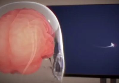 Neuralink si propone di guidare un braccio robotico utilizzando il cervello – Future Tech