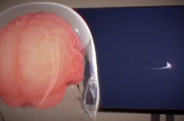 Neuralink si propone di guidare un braccio robotico utilizzando il cervello – Future Tech
