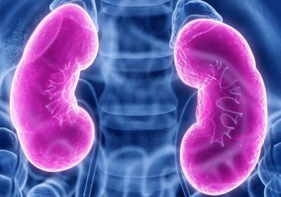 Insufficienza renale, come si manifesta e com’è collegata alla sepsi