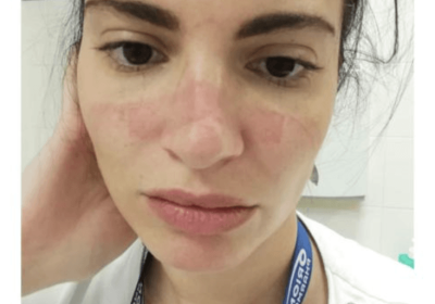 Covid-19, cinque anni dopo la pandemia la sanità pubblica italiana è finita nell’oblìo