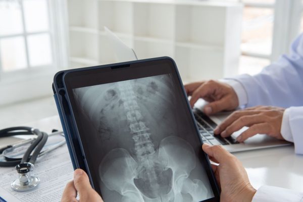 Lesioni spinali, il futuro della cura tra stimolazione elettrica cerebrale ed epidurale