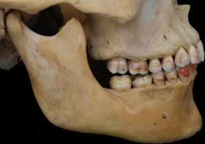 Principessa rossa, il misterioso scheletro con i denti tinti è una scoperta scientifica unica