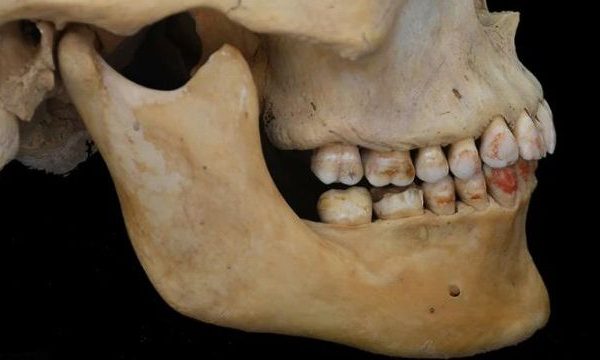 Principessa rossa, il misterioso scheletro con i denti tinti è una scoperta scientifica unica