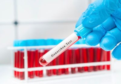 Nuovo antibiotico scoperto, potrebbe combattere uno dei superbatteri più pericolosi di sempre