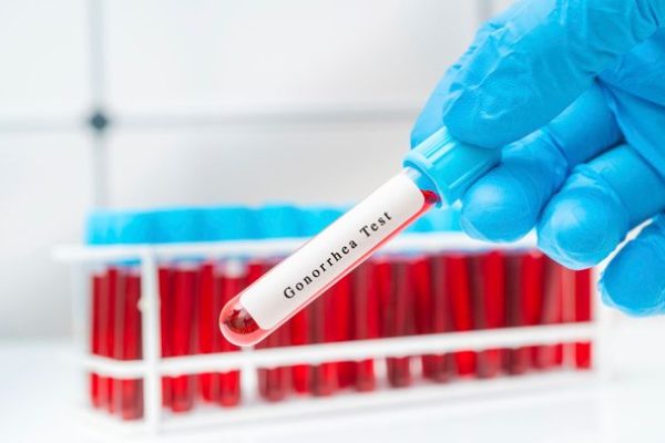 Nuovo antibiotico scoperto, potrebbe combattere uno dei superbatteri più pericolosi di sempre
