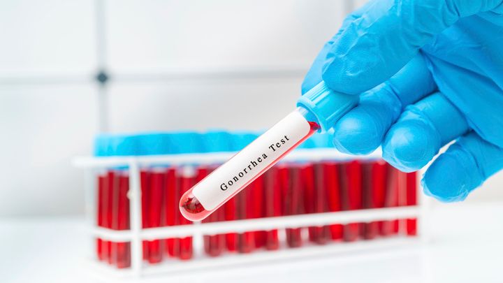 Nuovo antibiotico scoperto, potrebbe combattere uno dei superbatteri più pericolosi di sempre