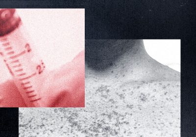 Morbillo negli Stati Uniti, i no-vax lo sfruttano per promuovere teorie del complotto e pseudo-cure