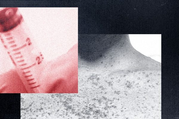 Morbillo negli Stati Uniti, i no-vax lo sfruttano per promuovere teorie del complotto e pseudo-cure