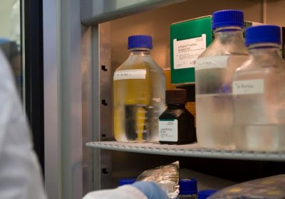 Immunoterapia, al via la fase dei test del farmaco italiano per renderla più sicura