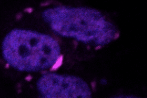 Malattie neurodegenerative, arriva l’algoritmo che fiuta le proteine tossiche