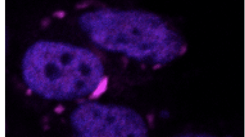 Malattie neurodegenerative, arriva l’algoritmo che fiuta le proteine tossiche