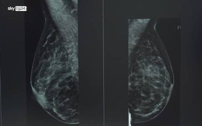 Cancro al seno, Health Triage sviluppa uno screening con I.A.