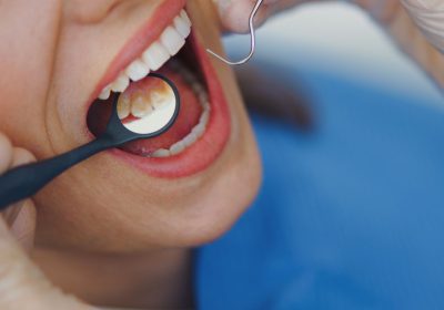 Batterio nelle gengive che può arrivare fino al cuore, come riesce ad ingannare le difese immunitarie