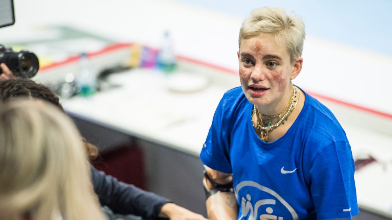 WEmbrace Games, oggi al via la 13esima edizione dei giochi di Bebe Vio