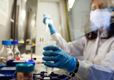 La cura per l’Hiv è più vicina grazie a nanoparticelle che trasportano la tecnologia mRna