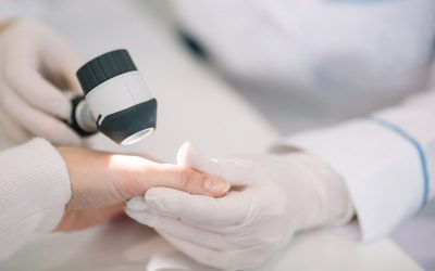 I casi di scabbia, la malattia della pelle pruriginosa e molto contagiosa, stanno aumentando in Italia