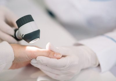 I casi di scabbia, la malattia della pelle pruriginosa e molto contagiosa, stanno aumentando in Italia