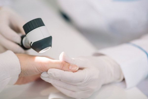 I casi di scabbia, la malattia della pelle pruriginosa e molto contagiosa, stanno aumentando in Italia