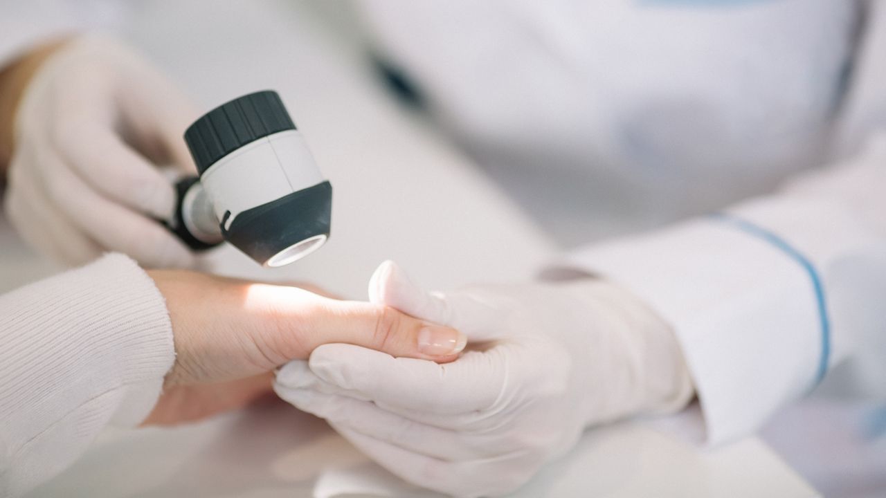 I casi di scabbia, la malattia della pelle pruriginosa e molto contagiosa, stanno aumentando in Italia