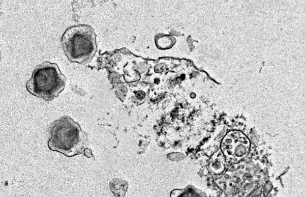 Identificati 230 nuovi virus giganti negli oceani, alcuni potrebbero influenzare la fotosintesi nelle alghe