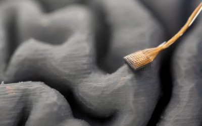 Nuova interfaccia cervello-computer consente a paziente con SLA di parlare in tempo reale
