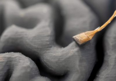 Nuova interfaccia cervello-computer consente a paziente con SLA di parlare in tempo reale