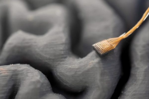 Nuova interfaccia cervello-computer consente a paziente con SLA di parlare in tempo reale