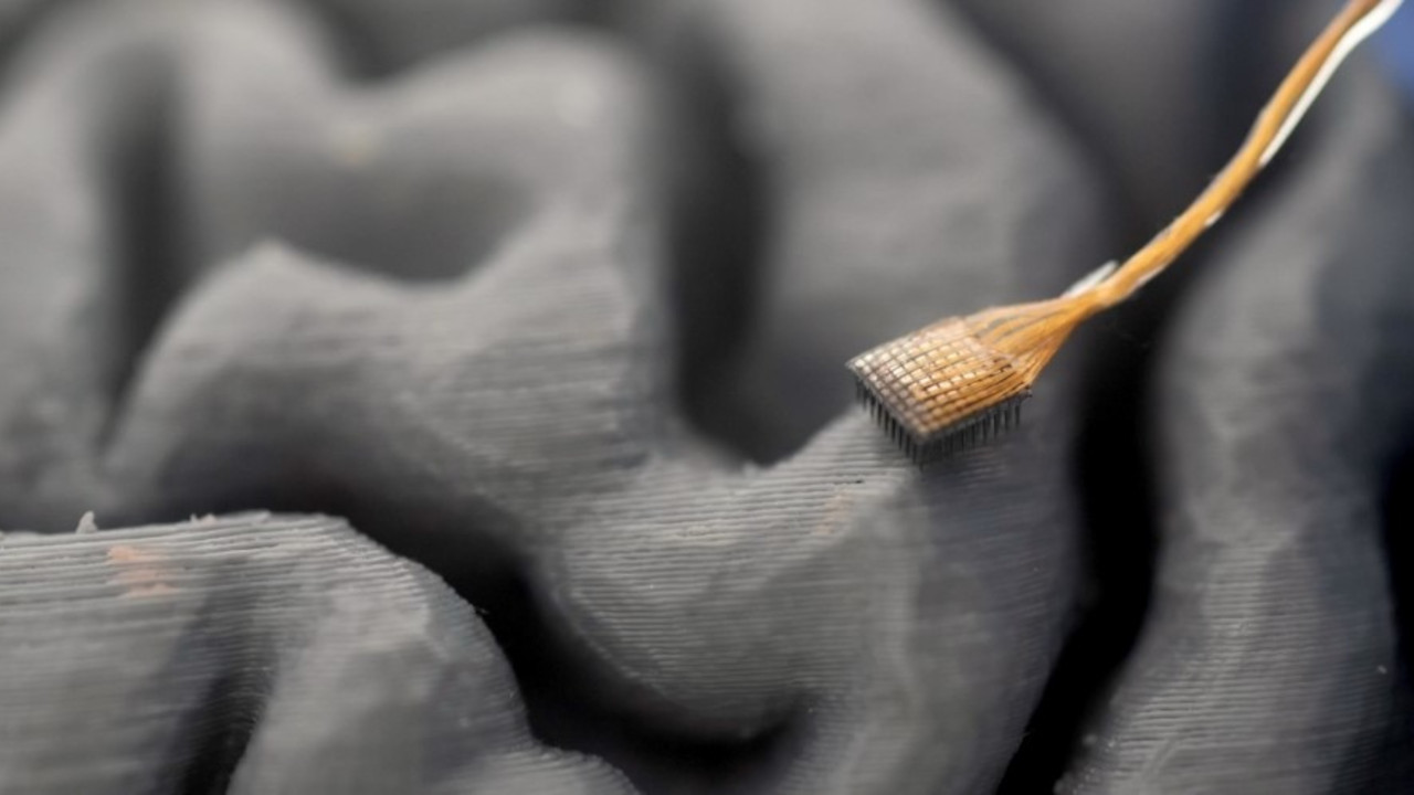 Nuova interfaccia cervello-computer consente a paziente con SLA di parlare in tempo reale