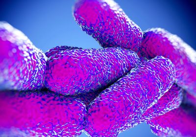 Come si prende la legionella, il batterio responsabile dell’infezione polmonare chiamata legionellosi