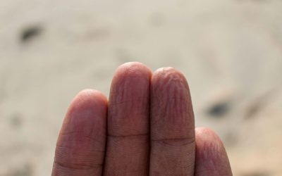 Dita raggrinzite sulle mani dopo essere stati in acqua, sapete che le increspature hanno sempre la stessa geometria?