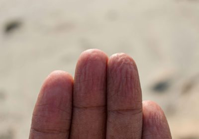 Dita raggrinzite sulle mani dopo essere stati in acqua, sapete che le increspature hanno sempre la stessa geometria?