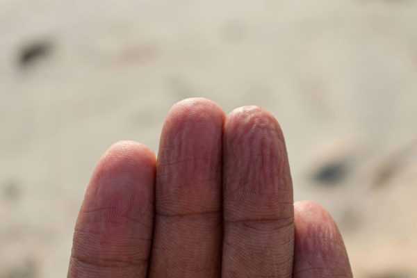Dita raggrinzite sulle mani dopo essere stati in acqua, sapete che le increspature hanno sempre la stessa geometria?