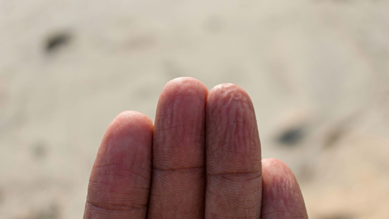 Dita raggrinzite sulle mani dopo essere stati in acqua, sapete che le increspature hanno sempre la stessa geometria?